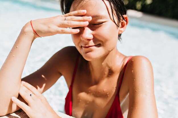 Effect of sun exposure and hydrochlorothiazide