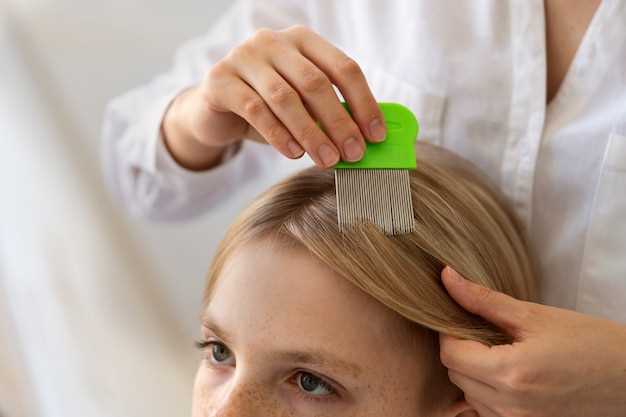 Hydrochlorothiazide and alopecia