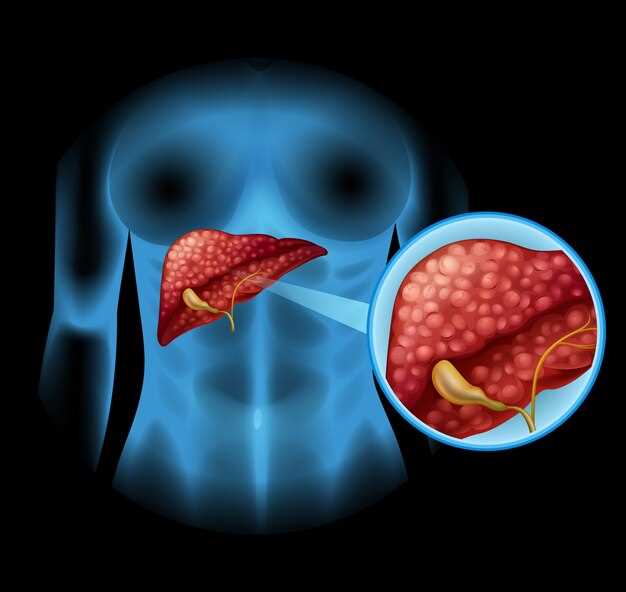 Hydrochlorothiazide and liver damage