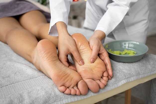 Hydrochlorothiazide gout treatment