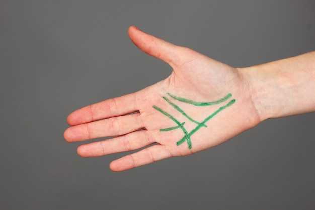 Hydrochlorothiazide tingling in hands