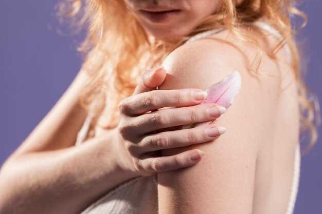 Skin rash hydrochlorothiazide